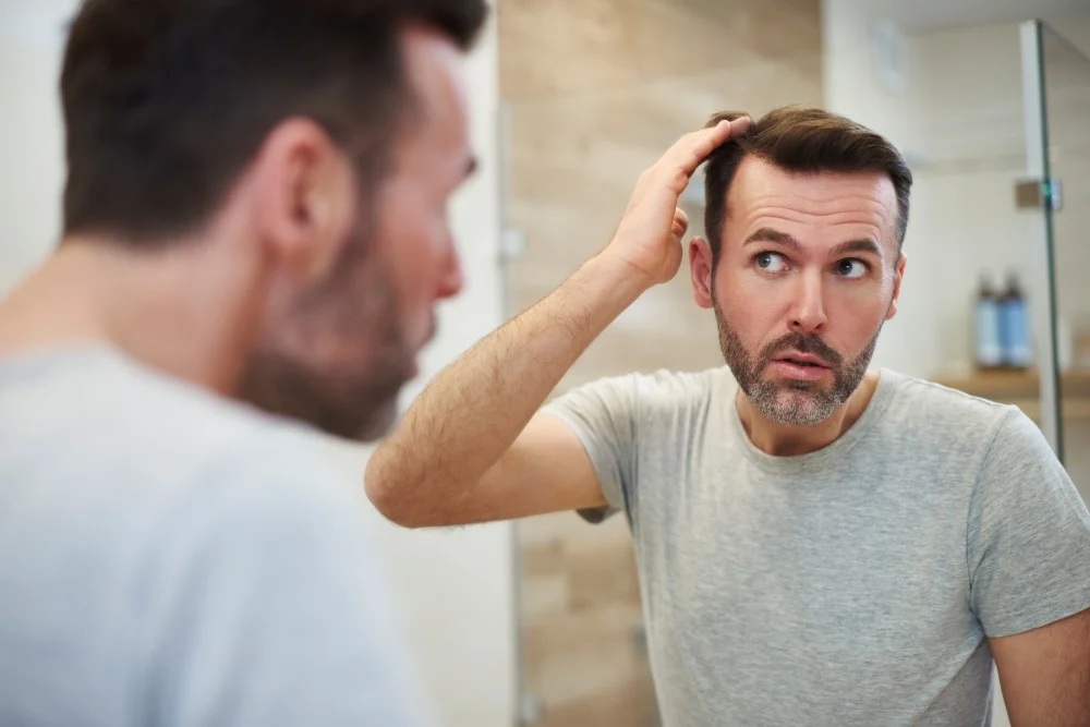 hair-loss-in-men